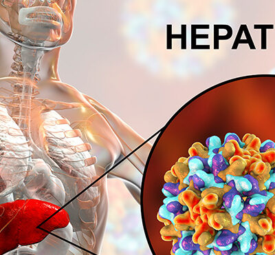 Hepatit B Nedir_
